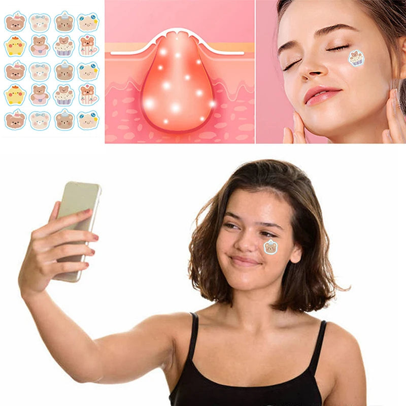 100 Patches Bear Shape Pimple Patches Colorful Hydrocolloid Pimple Healing Sticker Cute Strong Absorption Zit Patches Face Care