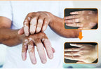 Effectively Remove Vitiligo Ointment Ringworm White Spot Removal Skin Vitiligo Eliminate Vitiligo Skin Care