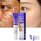 Amino Acid Freckle Whitening Cream Fade Pigmentation Melasma Dark Spots Corrector Repair Cream Korean Skin Care
