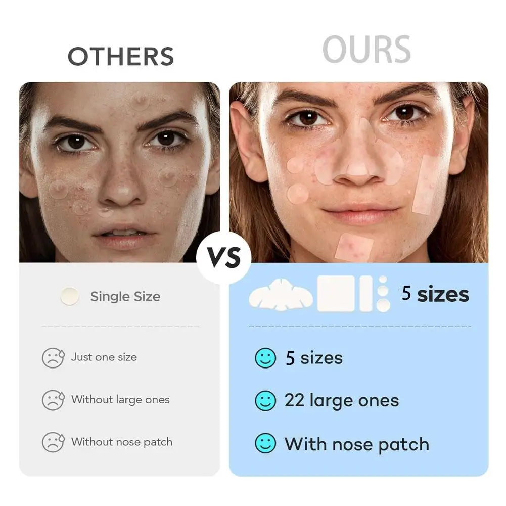 262/360Pcs Cute Colorful Pimple Patches Acne Treatment Stickers Invisible Acne Cover Face Spot Pimple Patch Skin Care Makeup