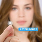 262/360Pcs Cute Colorful Pimple Patches Acne Treatment Stickers Invisible Acne Cover Face Spot Pimple Patch Skin Care Makeup