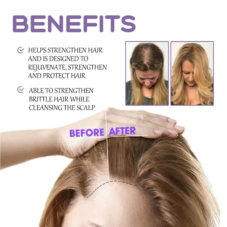 Googeer Hair Follicle Dense Hair Drops Repair Hair Follicle Nourishing Hair Roots Dense Solid Hair Care