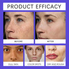 Amino Acid Freckle Whitening Cream Fade Pigmentation Melasma Dark Spots Corrector Repair Cream Korean Skin Care