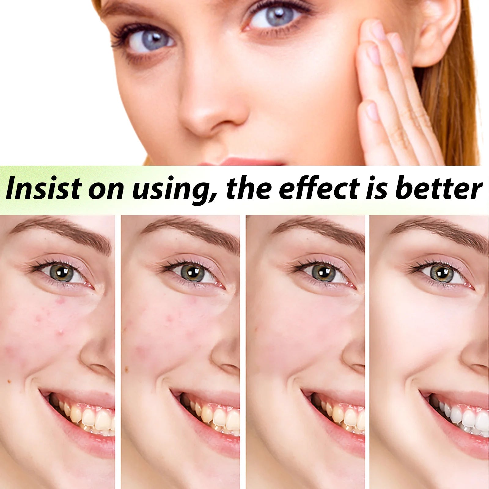 Acne Face Cream Pimple Treatment Oil Control Repair Redness Remove Blackhead Smooth Hydrating Moisturizing Pore Shrinking Serum