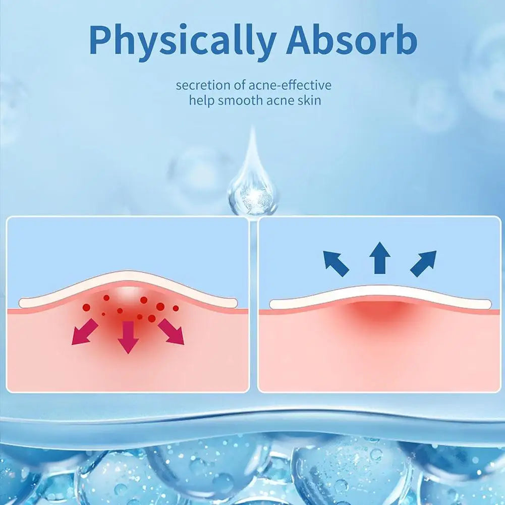 262/360Pcs Cute Colorful Pimple Patches Acne Treatment Stickers Invisible Acne Cover Face Spot Pimple Patch Skin Care Makeup