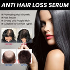 OUHOE AntiLoss Serum Solid Hair Dense Hair Repair Hair Root Dense Nutrition Strong Scalp Care Hair Care Essence