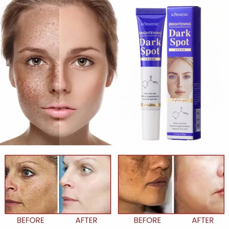 Amino Acid Freckle Whitening Cream Fade Pigmentation Melasma Dark Spots Corrector Repair Cream Korean Skin Care