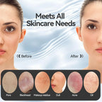 Facial Cleansing Brush, Silicone Face Scrubber with Heat and Vibration 5 Speeds, Waterproof Rechargeable Electric Face Scrub Bru