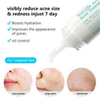 AUQUEST Salicylic Acid Acne Face Cream Pore Blackhead Removal Oil Control Niacinamide Facial Cream Skin Care