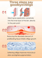 Effectively Remove Vitiligo Ointment Ringworm White Spot Removal Skin Vitiligo Eliminate Vitiligo Skin Care