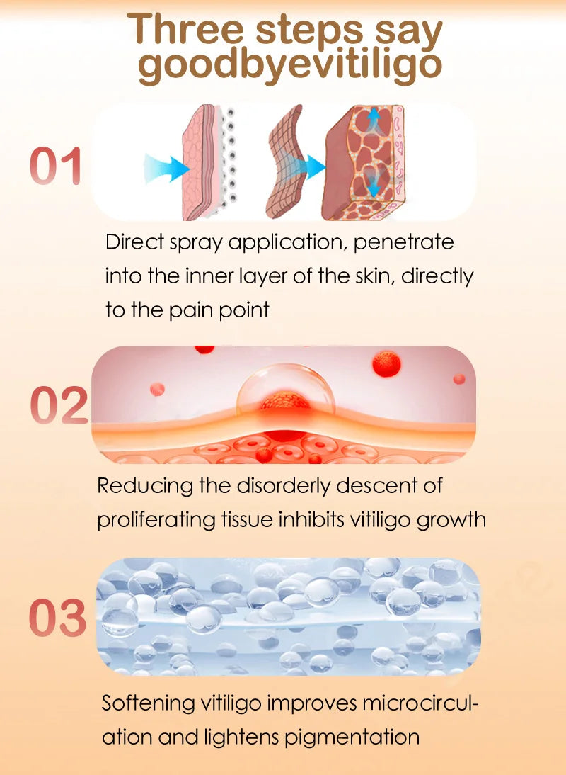 Effectively Remove Vitiligo Ointment Ringworm White Spot Removal Skin Vitiligo Eliminate Vitiligo Skin Care
