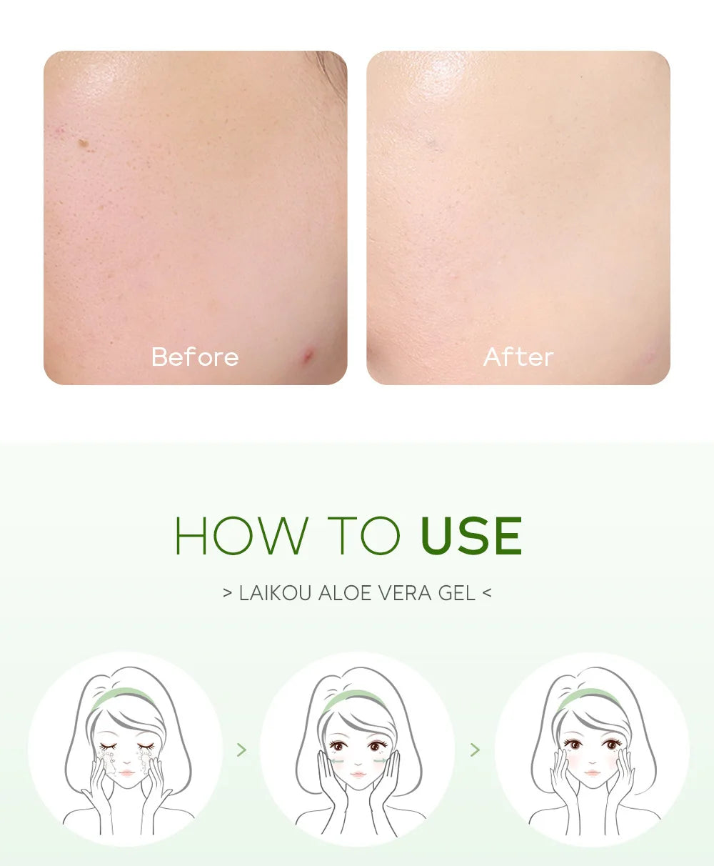 LAIKOU Aloe Vera Gel Face Cream Hyaluronic Acid Moisturizing  Refreshing and Non-sticky Cream Skin Care