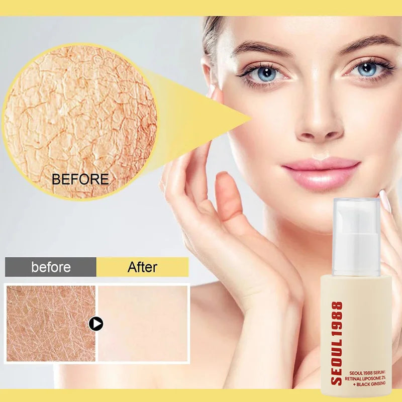 Korean Skin Care Seoul 1988 Vitamin C Wrinkle Care 4% Retinol Ginseng Serum Firm Fine Lines Eye Cream  Moisturizing Brighten Set