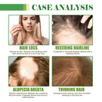 OUHOE Hair Care Oil Repair Damage Improve Dry Hair Prevent Hair Loss And Smooth Essential Oil