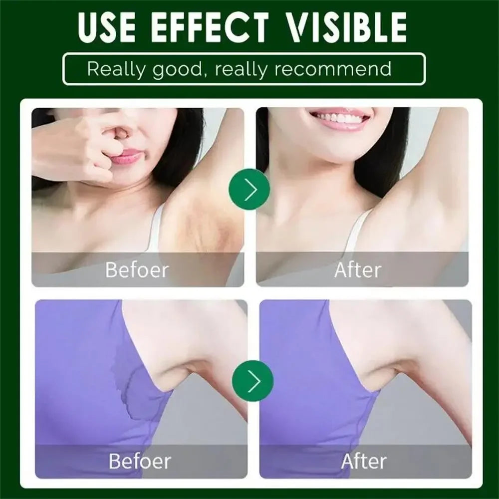 Body Odor Remove Cream Underarm Bad Smell Sweating Removal Armpit Refreshing Antiperspirant Lasting Aroma Deodorant Body Care