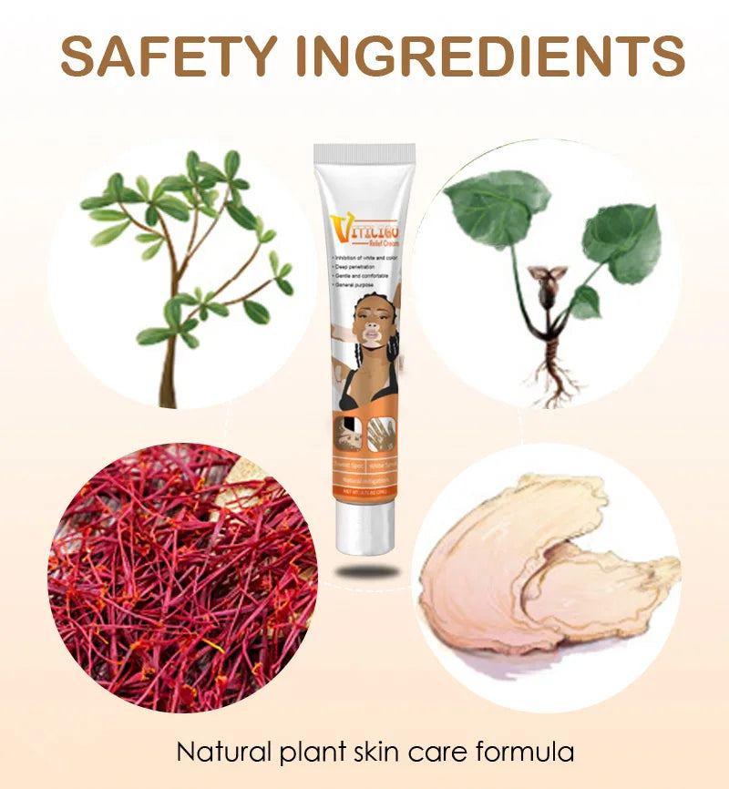 Effectively Remove Vitiligo Ointment Ringworm White Spot Removal Skin Vitiligo Eliminate Vitiligo Skin Care