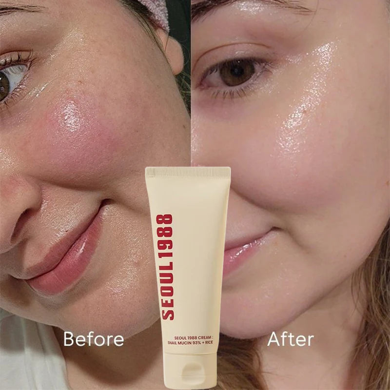 Korean Skin Care Seoul 1988 Vitamin C Wrinkle Care 4% Retinol Ginseng Serum Firm Fine Lines Eye Cream  Moisturizing Brighten Set