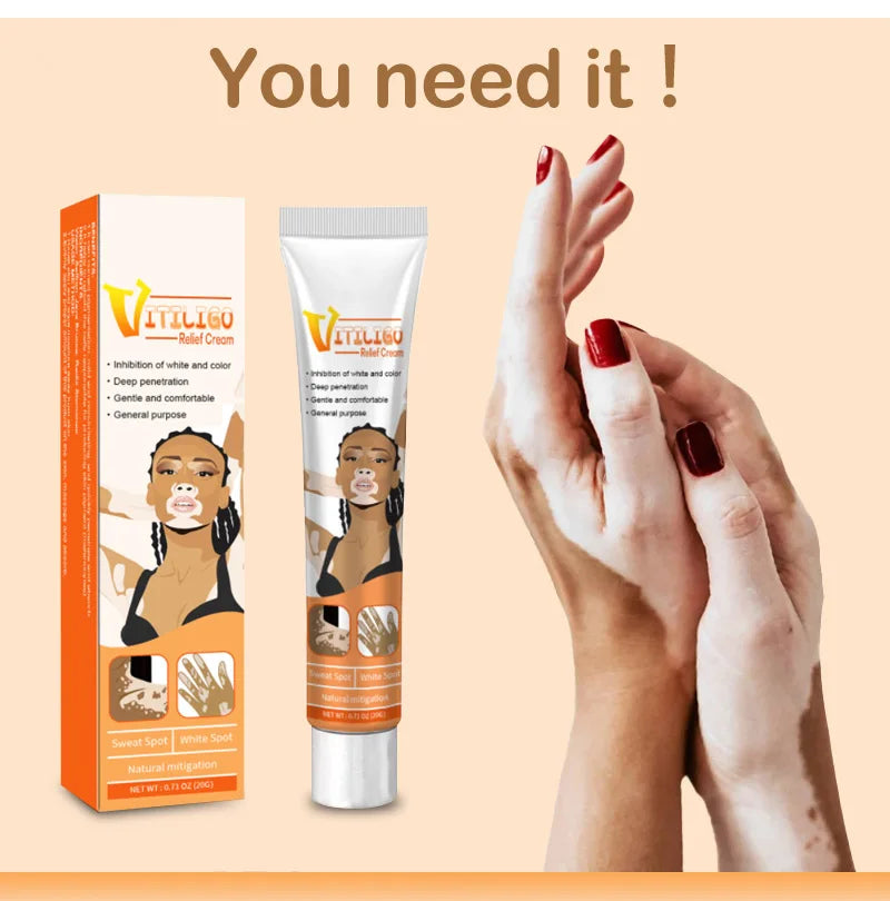 Effectively Remove Vitiligo Ointment Ringworm White Spot Removal Skin Vitiligo Eliminate Vitiligo Skin Care