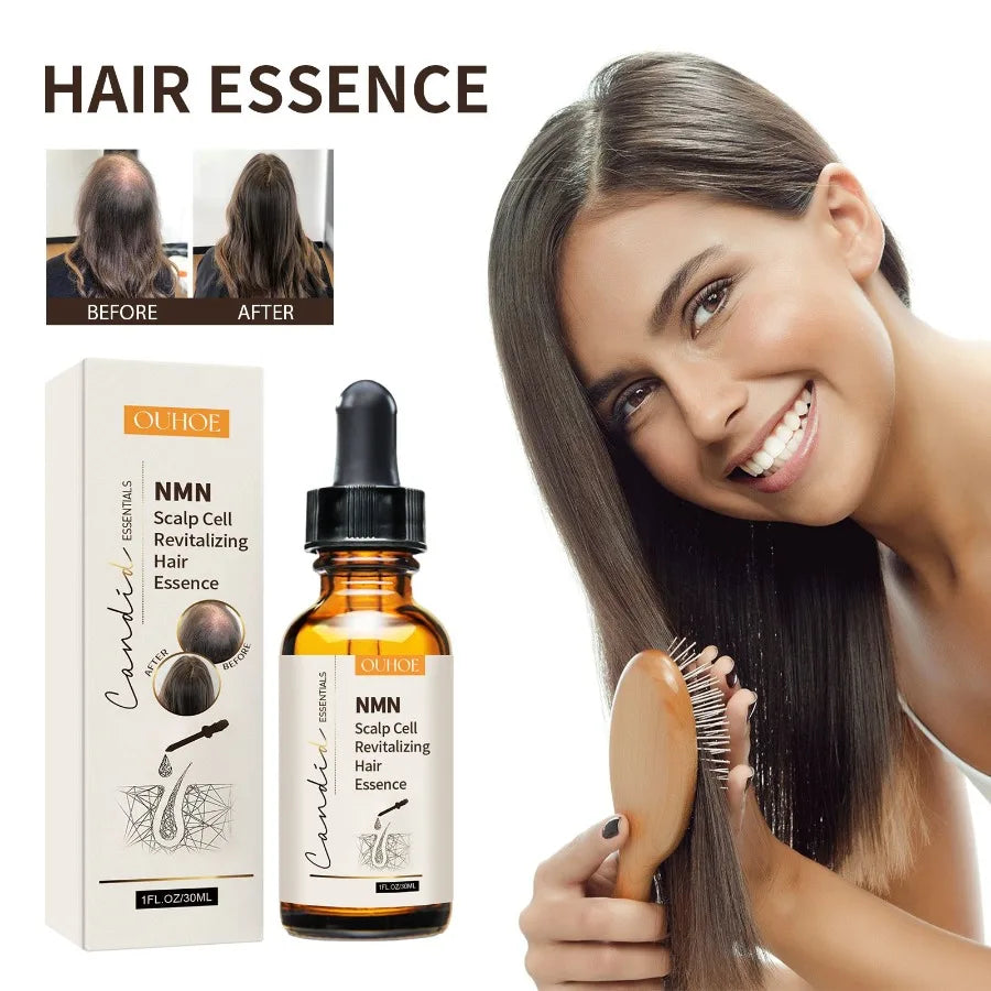 OUHOE NMN Scalp Cell Revitalizing Hair Essence Hair Care Strengthen And Strengthen Hair Repair Hair Root Thickening Hair Moistu
