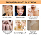 Effectively Remove Vitiligo Ointment Ringworm White Spot Removal Skin Vitiligo Eliminate Vitiligo Skin Care