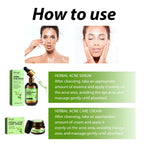 Acne Face Cream Pimple Treatment Oil Control Repair Redness Remove Blackhead Smooth Hydrating Moisturizing Pore Shrinking Serum