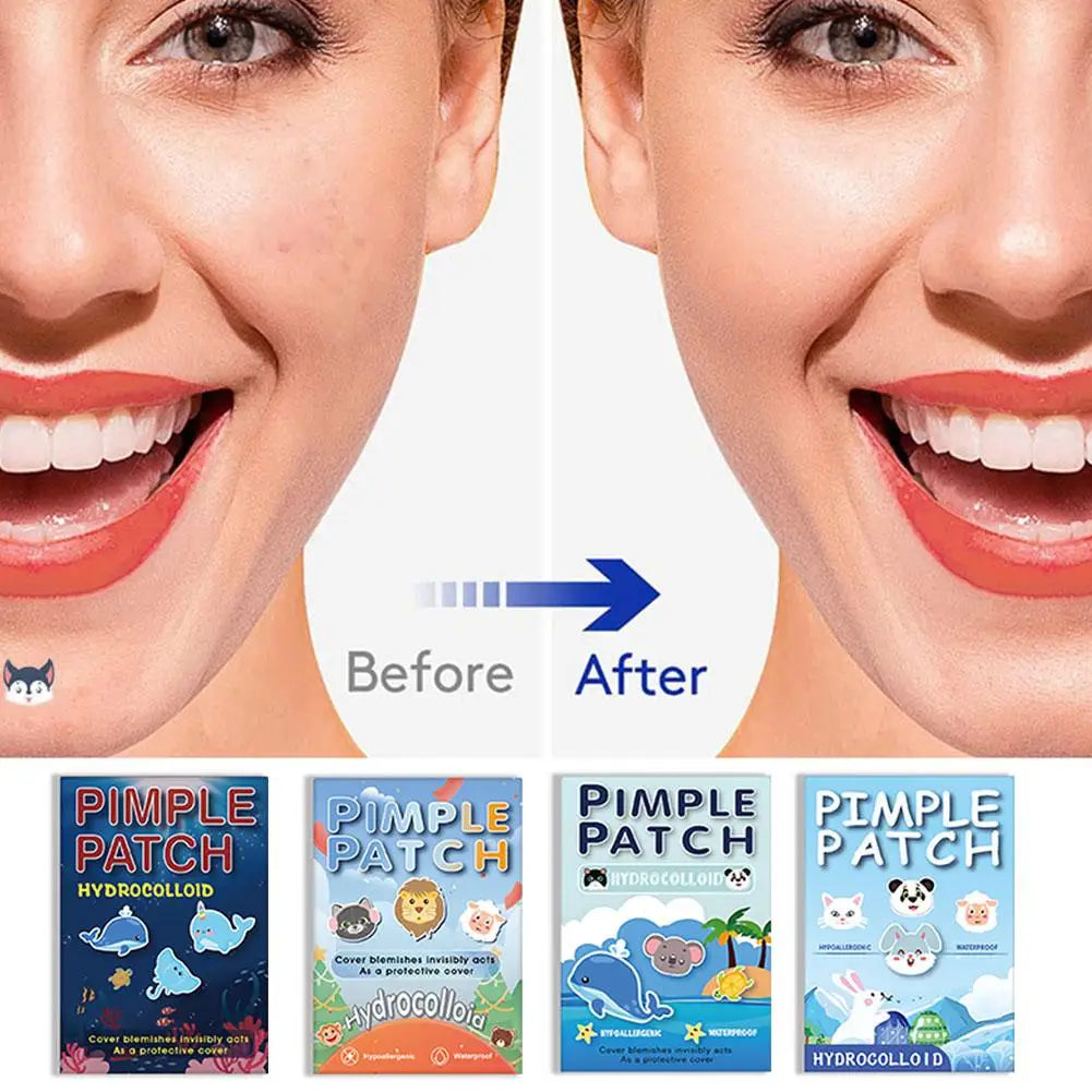 600PCS High-end Pimple Invisible Ultra-thin And Breathable Pimples Patch Cartoon Acne Patch Cute Cat Shaped Acne Dots Patches