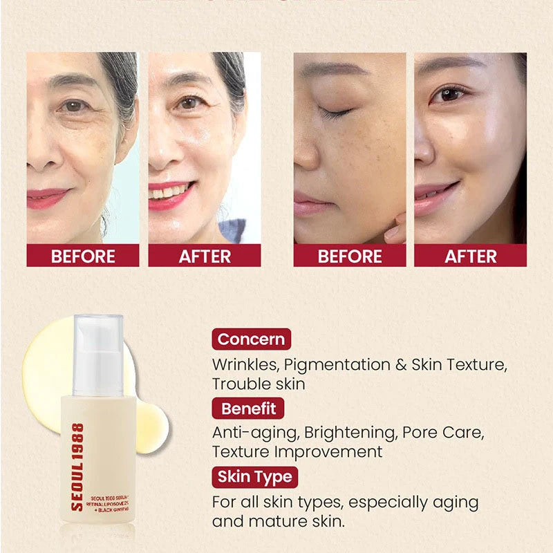 Korean Skin Care Seoul 1988 Vitamin C Wrinkle Care 4% Retinol Ginseng Serum Firm Fine Lines Eye Cream  Moisturizing Brighten Set