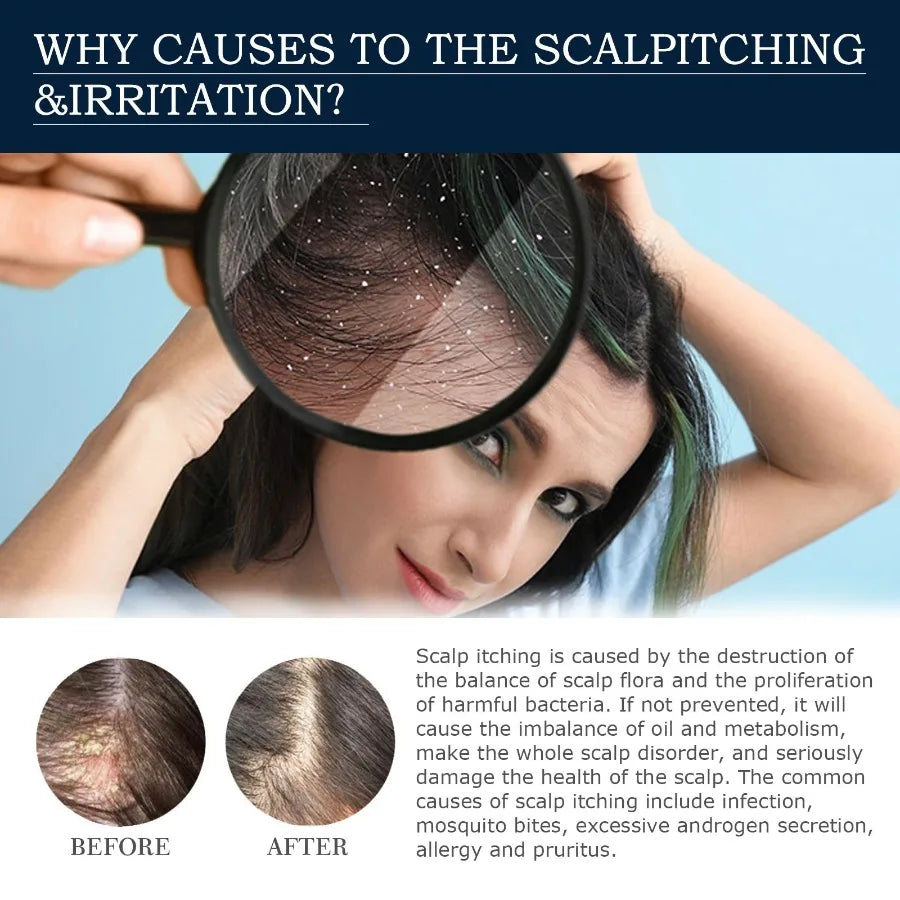 WestMonth Scalp Treatment Essence Spray Hair Care And Repair Damaged Hair Follicle Hair Root Treatment Spray