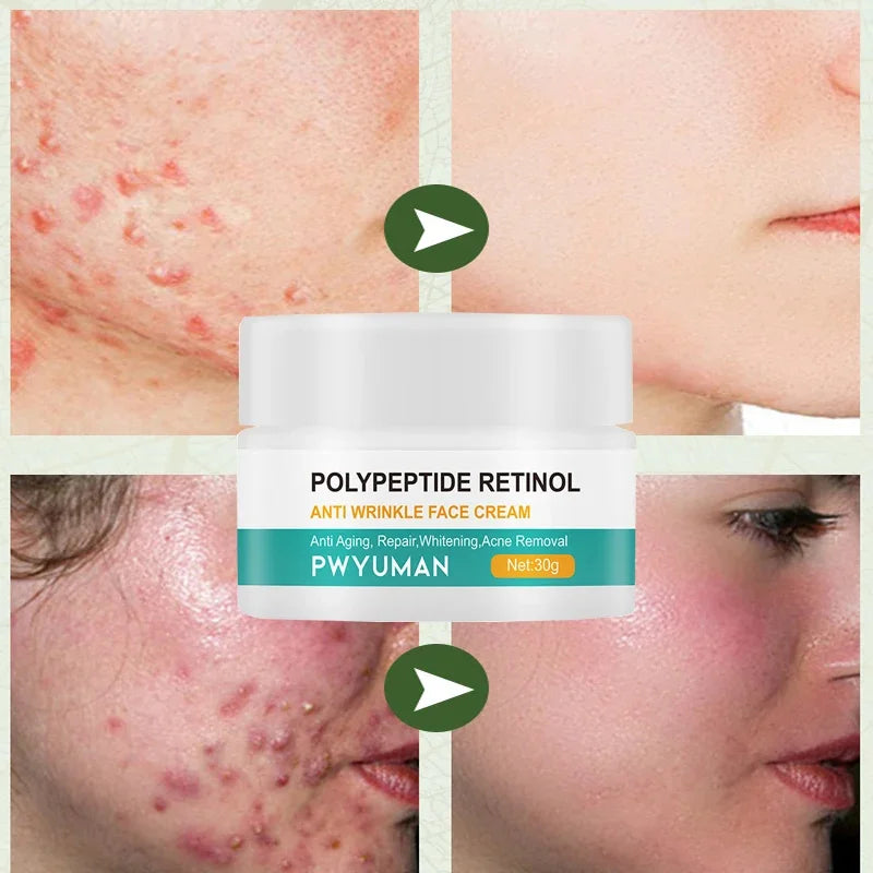 Instant Retinol Lifting Firming Cream Polypeptide Wrinkle Remover Face Cream For Men Moisturizer Whitening Brighten Skin Product