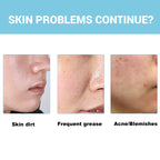 Facial Foaming Cleanser For Clean Pores Oil Control Brightening Skin Rejuvenation Deep Cleansing Moisturizing Face Wash Cleanser