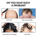 OUHOE AntiLoss Serum Solid Hair Dense Hair Repair Hair Root Dense Nutrition Strong Scalp Care Hair Care Essence