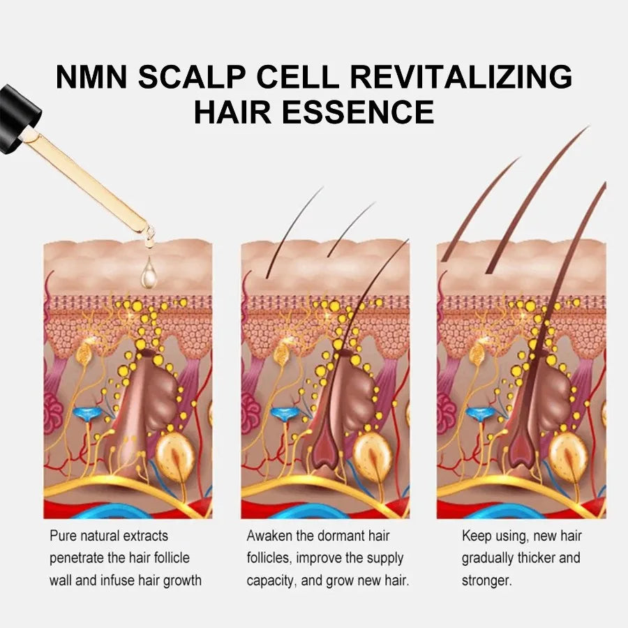OUHOE NMN Scalp Cell Revitalizing Hair Essence Hair Care Strengthen And Strengthen Hair Repair Hair Root Thickening Hair Moistu