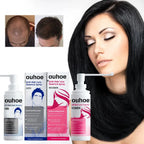 OUHOE AntiLoss Serum Solid Hair Dense Hair Repair Hair Root Dense Nutrition Strong Scalp Care Hair Care Essence