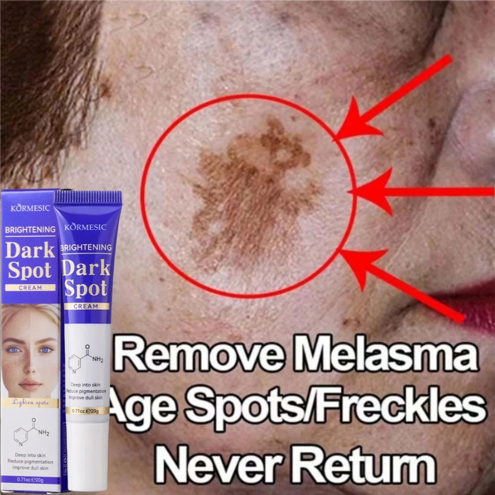 Amino Acid Freckle Whitening Cream Fade Pigmentation Melasma Dark Spots Corrector Repair Cream Korean Skin Care
