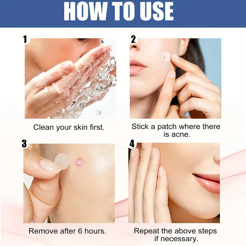 18/180pcs Pimple Patches Acne Patch Cute Pimple Acne Cover Stickers, Invisible Acne Patches For Acne Dots Beauty Makeup Tool