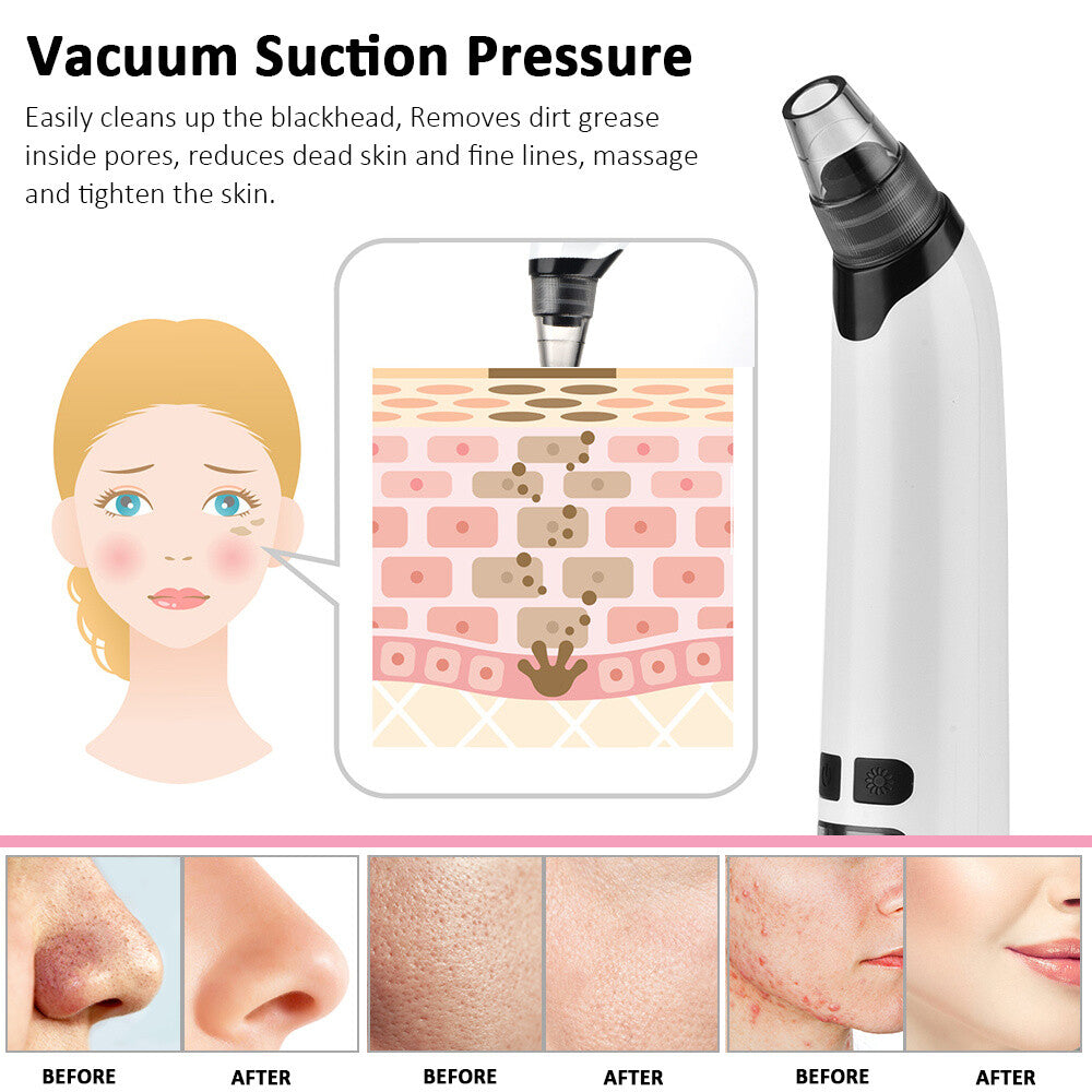 Blackhead Remover Pore Vacuum Facial Cleaner Electric Acne Comedone Extractor US