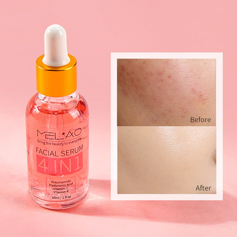 Multi-Action Niacinamide Serum-Complex