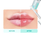 Hydrating Moisturizing And Nourishing Base To Improve Lip Lines Lip Essence Oil