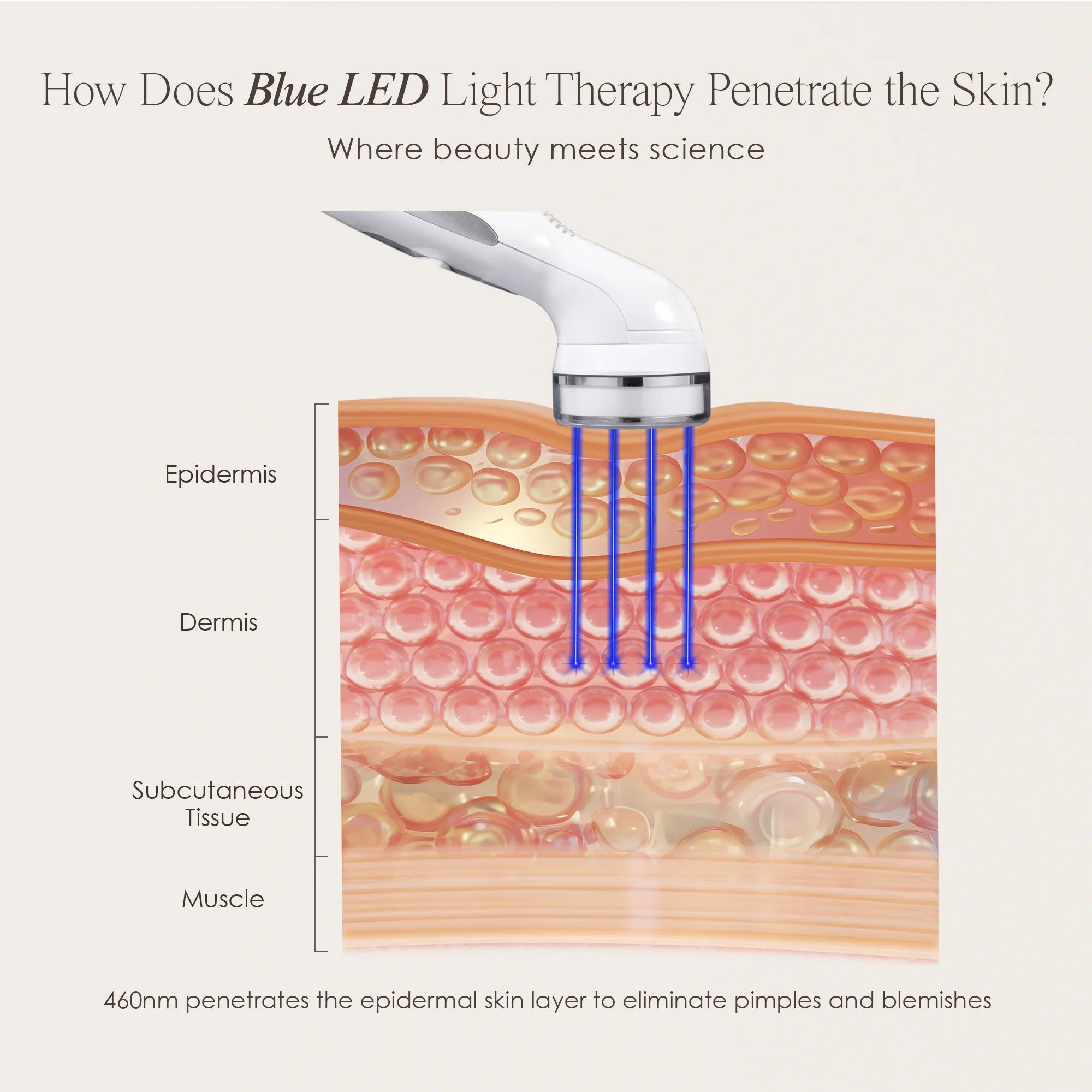 Blue LED+ | Acne Light Therapy | Spots Removal | Minimize Pores | for Oily Skin