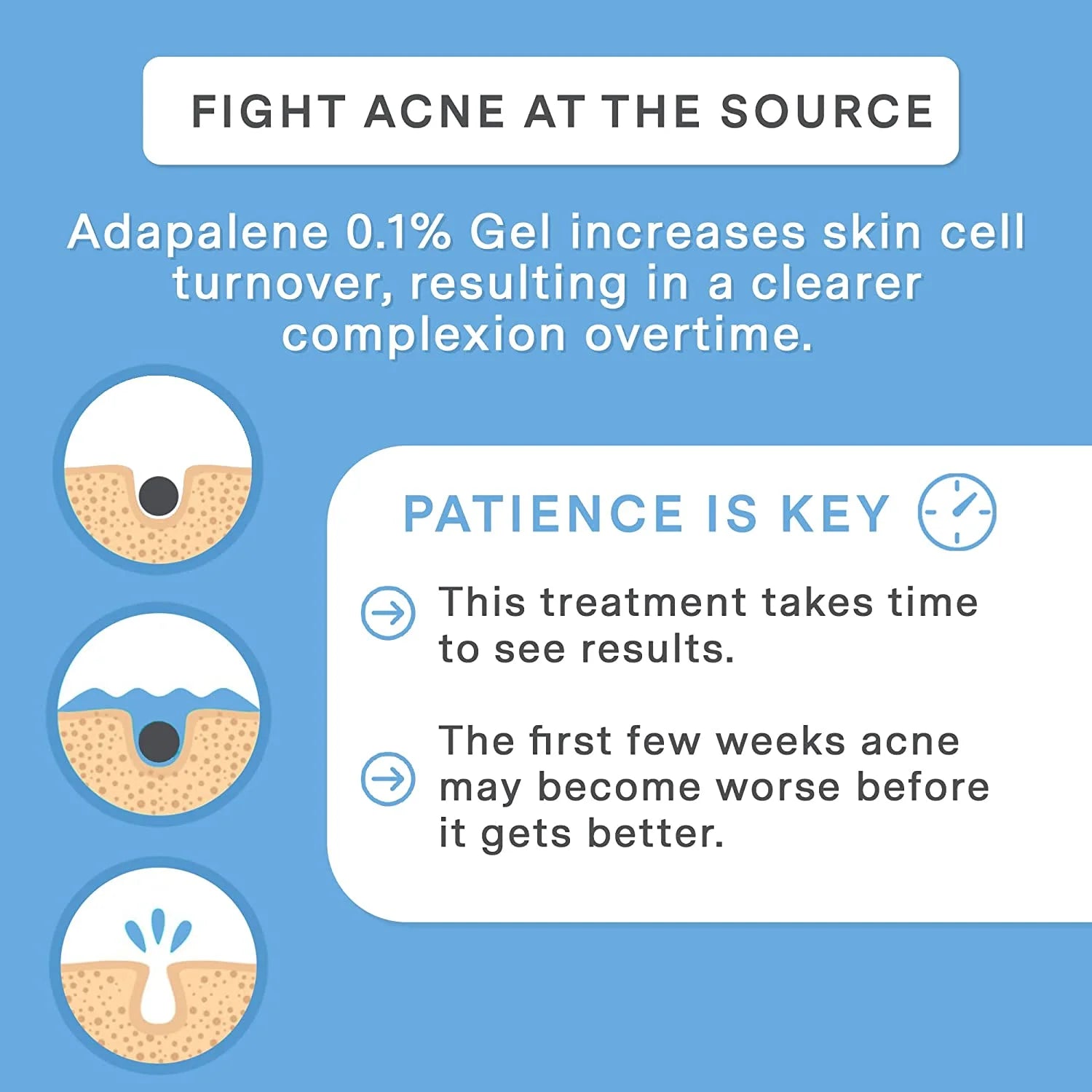 Adapalene Gel 0.1% Acne Treatment 1.6 Oz (45 G) | OTC Retinoid Acne Cream