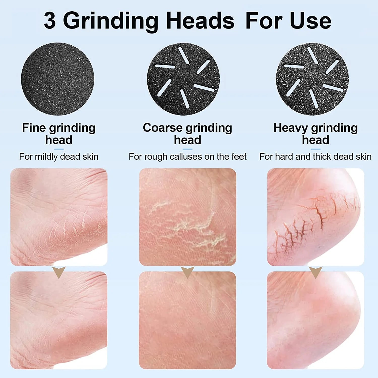 Electric Foot Callus Remover with Vacuum Cleaner, Rechargeable Foot File Dead Skin Remover with 2 Speed, 3 Grinding Head, LCD Display, Professional Kit for Foot Care Black