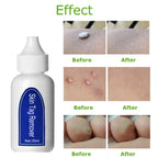 5Ml Quick Skin Blemish Spot Treatment