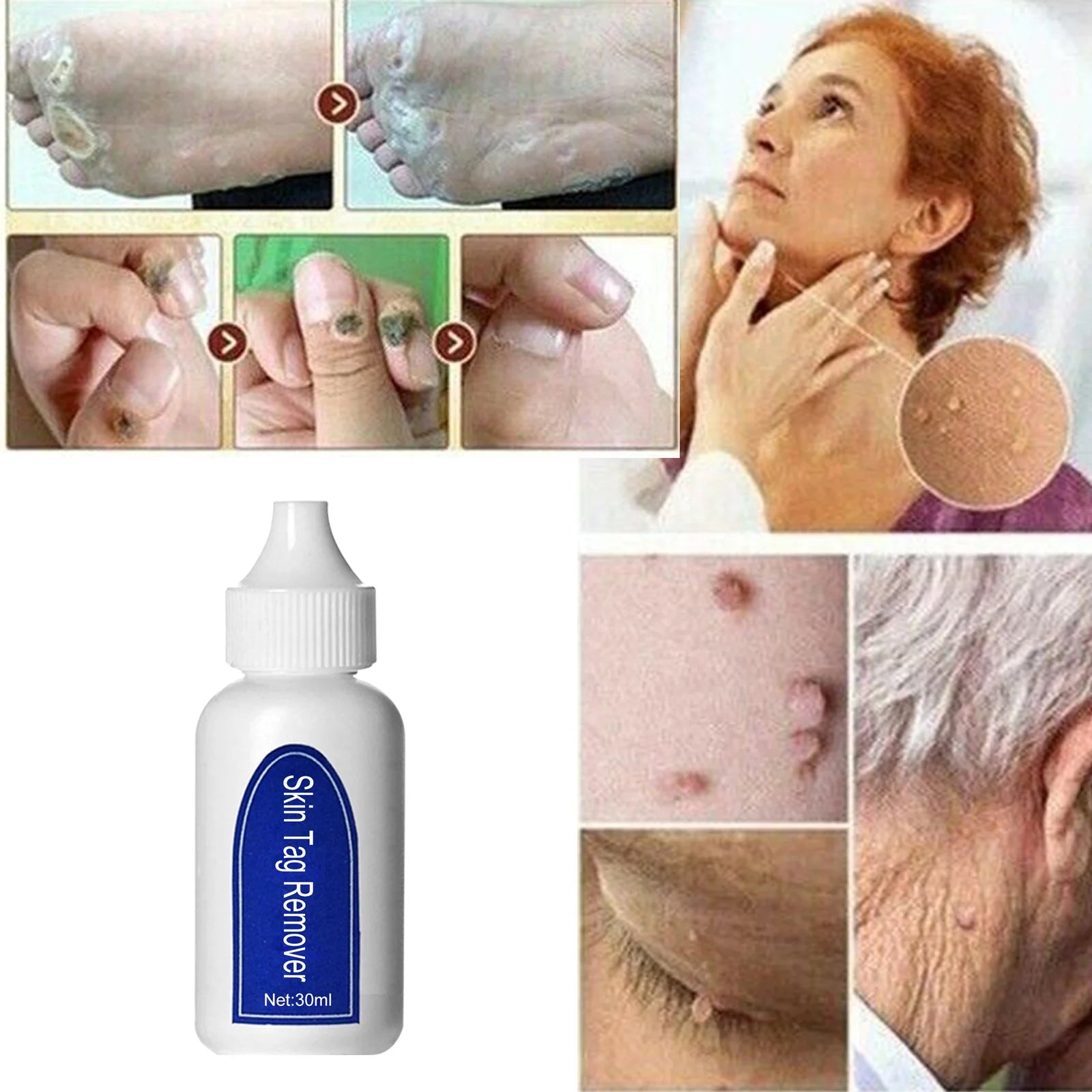 5Ml Quick Skin Blemish Spot Treatment