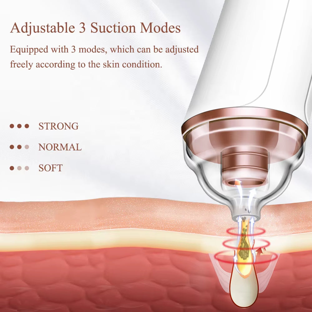 Factory Price Quick Delivery Skin Care Pore Cleaning Blackhead Vacuum Remover Rechargeable 3 Adjustable Levels Blackhead Remover