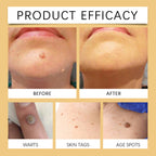 Herbal Mild Fade Skin Mole Skin Cleaning Care Cream