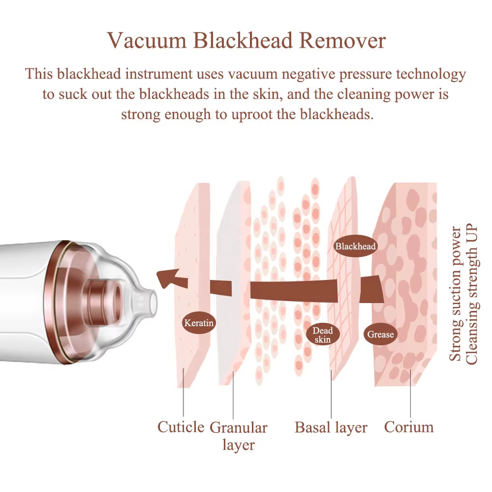 Factory Price Quick Delivery Skin Care Pore Cleaning Blackhead Vacuum Remover Rechargeable 3 Adjustable Levels Blackhead Remover