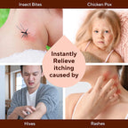 Itch Relief Soap Body Wash Bar - All Natural Instant Relief from Insect Bites, Chicken Pox, Chiggers and Other Skin Irritations Ie. Anti- Itch Calming Soap (2 Pack)