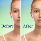 Maximum Strength Acne Foaming Cleanser Face and Body Wash with 10% Benzoyl Peroxide, Fast-Acting Acne Treatment, 5 Oz