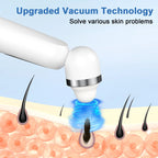 Blackhead Remover Vacuum, Blackhead Extractor with Camera, Pore Cleanser for Men and Women, Skin Care Tool with 5 Probes