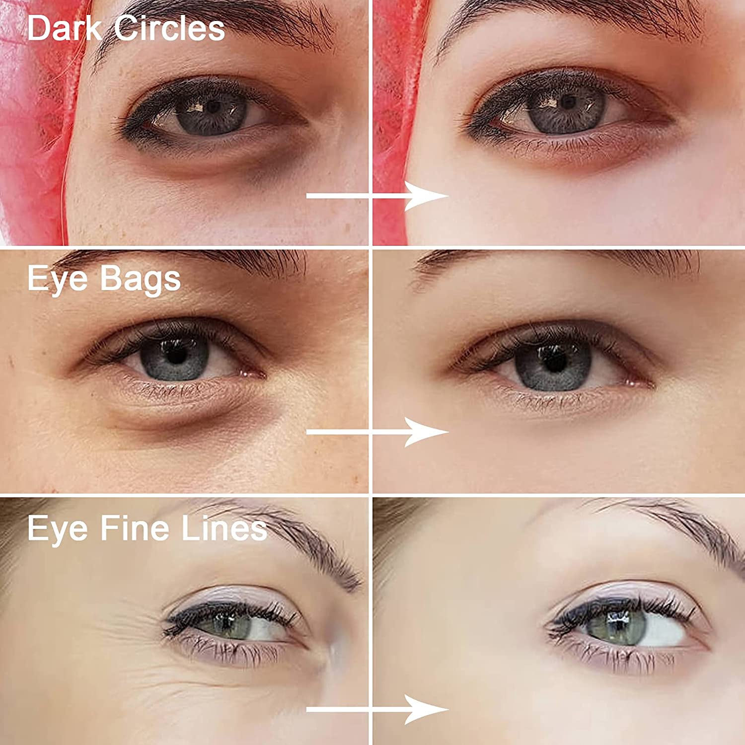 Parches De Colageno Desaparece Las Ojeras De Ojos Y La Arrugas Rapidamente